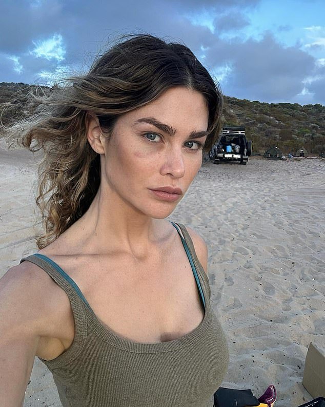 Megan Marx, from Bachelor, shares a Christmas selfie with a mysterious black eye while spending the day at the beach