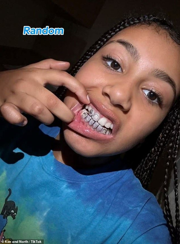 North West, 10, flaunts her dazzling dental accessory on TikTok amidst Kanye West’s surprising tooth extraction and disclosure of 0K titanium dentures