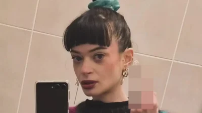 Ruth Codd Shares Health Update After Second Leg Amputation